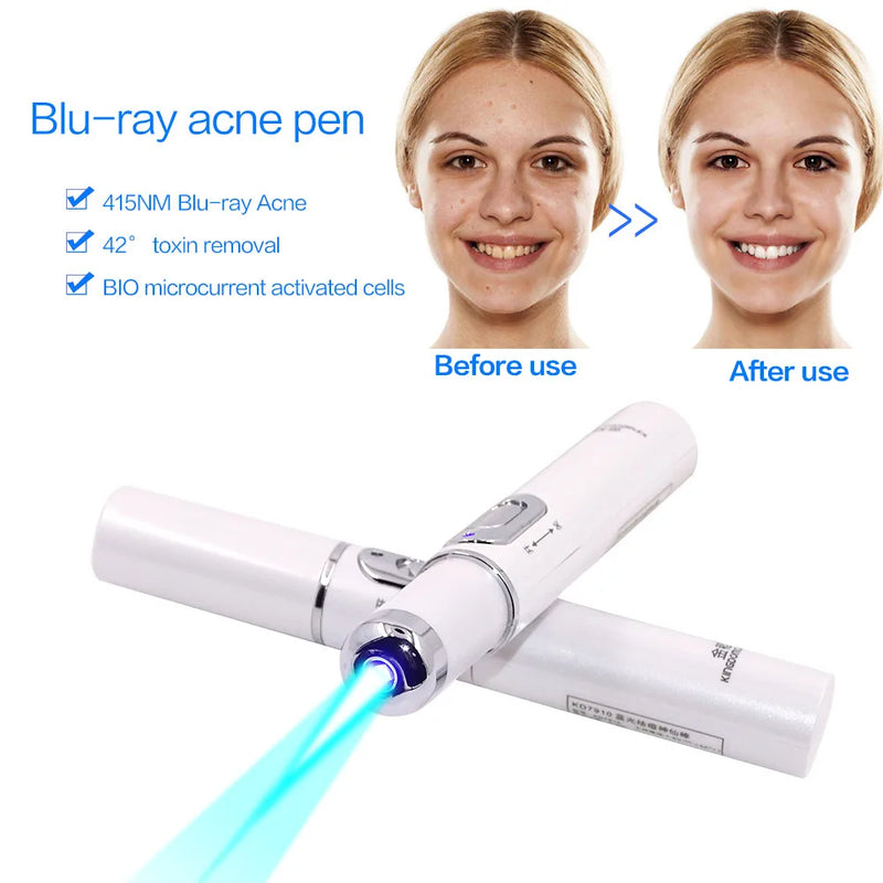 Máquina de luz azul para o rosto,Remoção de rugas da acne Caneta a laser Remoção de manchas da pele Anti-varizes ,Tratamento médico.